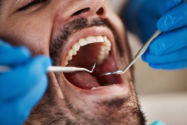 Best Holiday Emergency Dentist in Half Moon Bay, CA