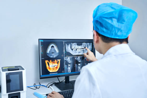 Best Emergency Dental Care for Abscessed Tooth in Half Moon Bay, CA